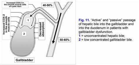 Gallbladder Dysfunction