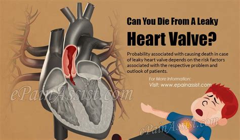 It depends on which valve and how leaky the valve is. Pin on Heart