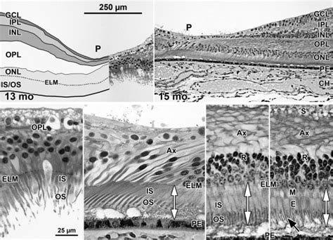 Histologic Development Of The Human Fovea From Midgestation To Maturity