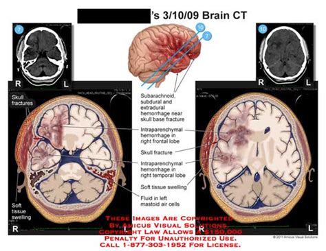 Medical Exhibits Demonstrative Aids Illustrations And Models