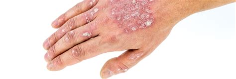 Common Skin Conditions And Treatments That Can Help