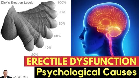 Psychological Causes Of Erectile Dysfunction By Dr Sam Robbins Youtube