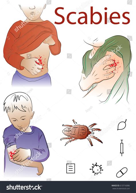 Itching Body Scabies Color Vector Illustration Stock Vector Royalty