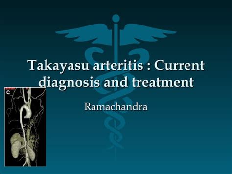 Takayasu Arteritis Ppt