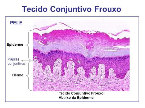 Tecido Conjuntivo Frouxo Corpo Humano Citologia