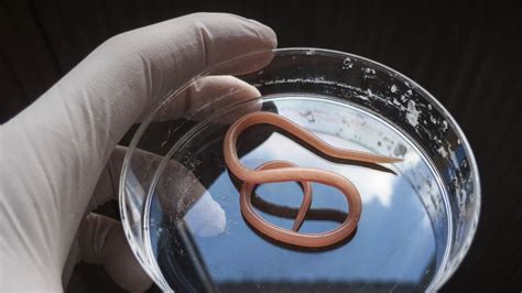 Roundworm Found In Human Gut Could Boost Fertility In Women Study