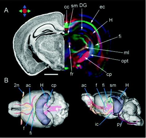 Magnetic Resonance Imaging Based Mouse Brain Atlas And Its Applications