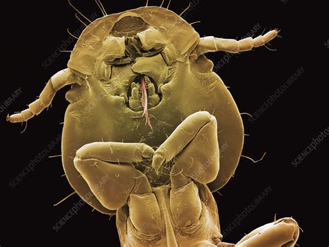 Feather Louse Head Sem Stock Image Z2650134 Science Photo Library