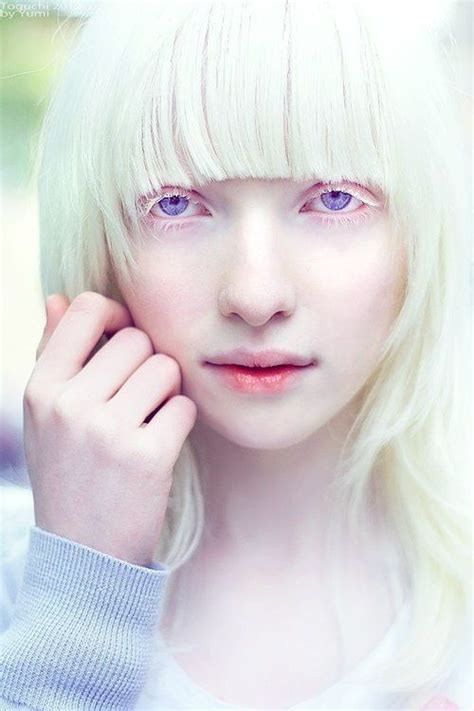 Albino Albino Model Albino Girl Albinism