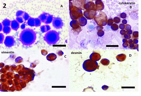The pleura (thoracal cavity), peritoneum (abdominal cavity including the mesentery) and pericardium. Non-neoplastic reactive mesothelial cells, dog with non ...