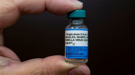 Indiana University Mumps Outbreak 16 Cases Confirmed