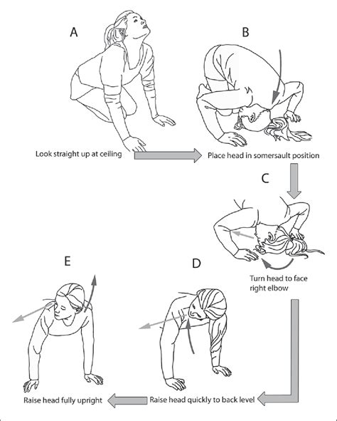 Figure 1 From A Comparison Of Two Home Exercises For Benign Positional