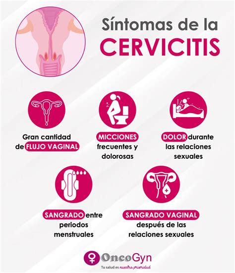 Sintomas Cervicitis Oncogyn