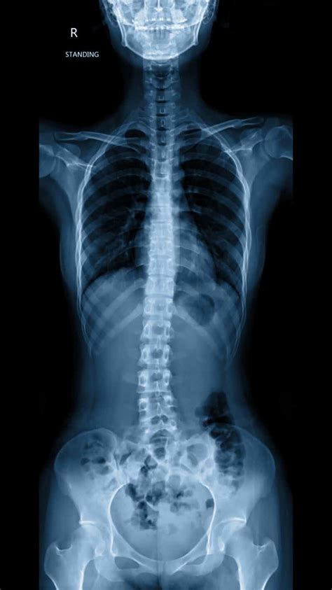 Upload your photo take photo. The Dangers of Misread X-Rays & CT Scans | Garau Germano