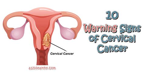 Cervical Cancer Symptoms 10 Warning Signs Of Cervical Cancer