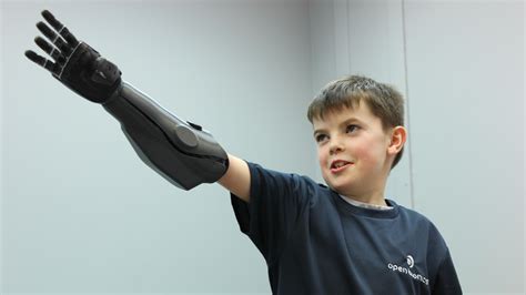 Worlds First 3d Printed Arms For Amputees Created By Open Bionics Bt
