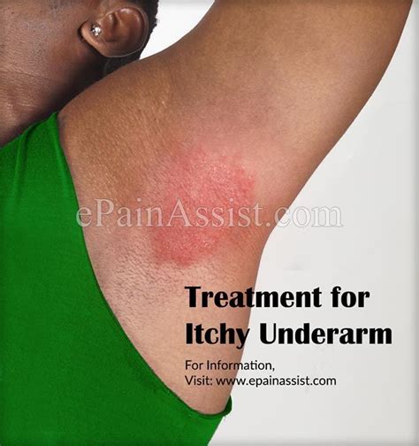 Treatment For Itchy Underarm Or Ways To Get Rid Of Itching In Armpits Armpitsdetox Itchy