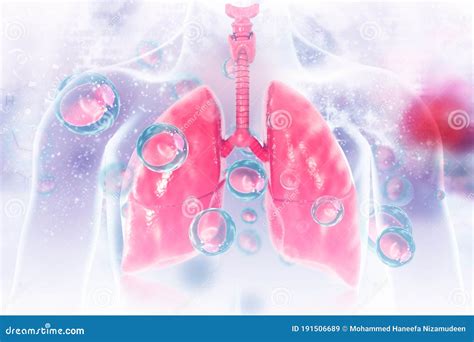 Virus And Bacteria Infected The Human Lungs Stock Illustration