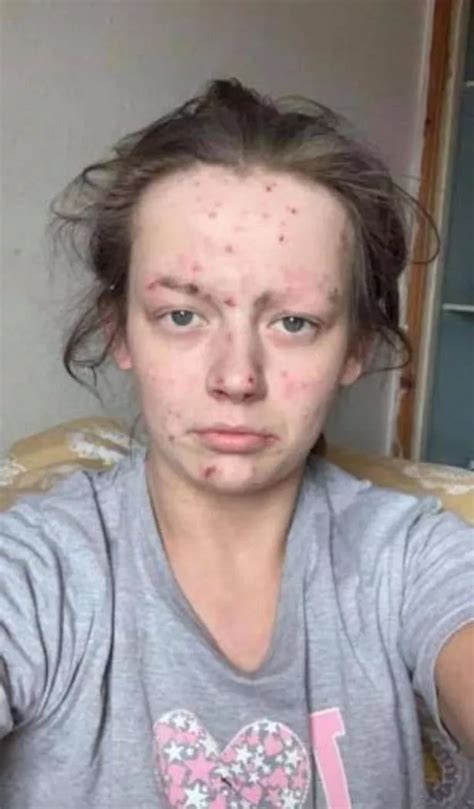Inspirational Snaps Show How Drug Addicts Look After Getting Clean