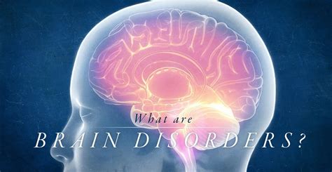 What Are Brain Disorders Pushasrx Athletic Training Centers El Paso Tx