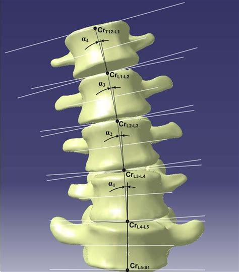 The Lumbar Spine With The Segments Representing L1 L2 L5 Vertebras