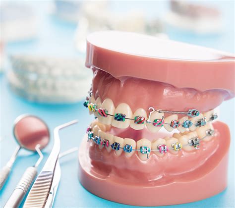 Early Orthodontic Treatment Is Beneficial Renewpurpose