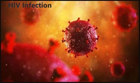 Infection With Hiv Helal Medical Sexually Transmitted Diseases Stds