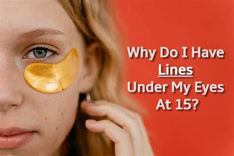 Why Do I Have Lines Under My Eyes At 15 4 Reasons