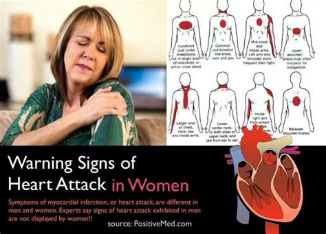 Warning Signs Of A Heart Attack In Women Signs Of Heart Attack