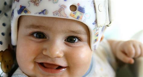 We did not find results for: Plagiocephaly (flat head syndrome) | BabyCenter