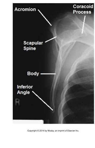 Upper Extremities Scapula Ac Joints Clavicle Shoulder Co Edition