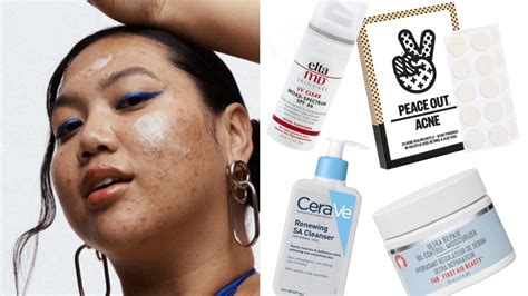 The 8 Best Products For Treating And Soothing Acne Prone Skin