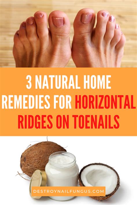 Horizontal Ridges On Toenails Causes And Home Remedies
