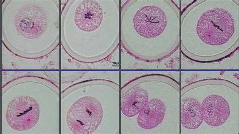 Ascaris Sp Mitosis Stages Youtube