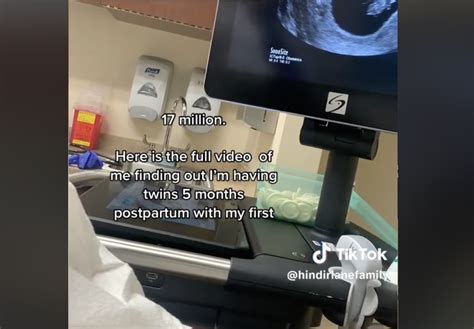 say what now mom goes viral after she is told she s having twins — and tells technician they re