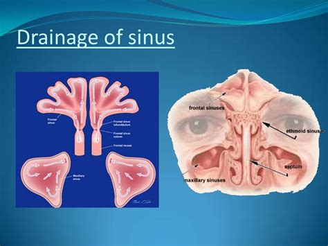 Surgical Anatomy Of Maxillary Sinus Note On 2
