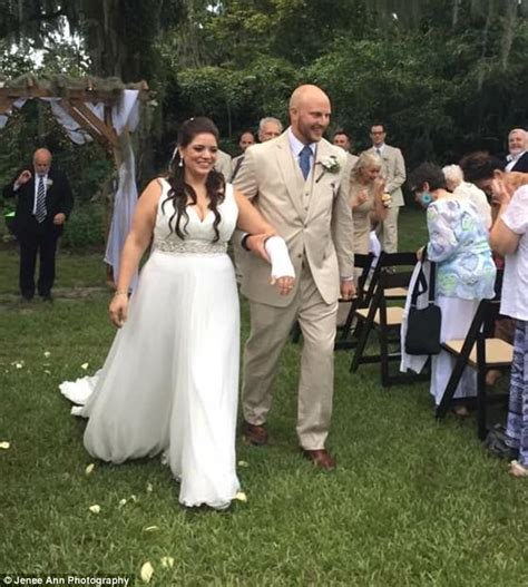 Bandaged Bride Shocked By Bridal Party In Matching Casts Daily Mail