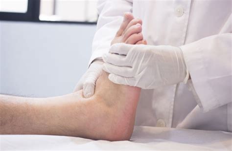How To Treat Cysts On Your Feet Solon Podiatrist