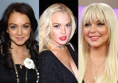 Lindsay Lohan Plastic Surgery Celeb Surgerycom