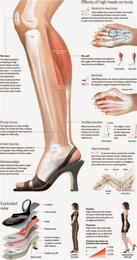 High Heels And Foot Injuries The Ugly Truth About Those Beautiful
