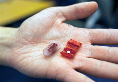 Capsule Robots The Future Of Gastrointestinal Diagnosis