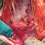 Histology Section Of Uterus  A Fallopian Tube B Cervix C