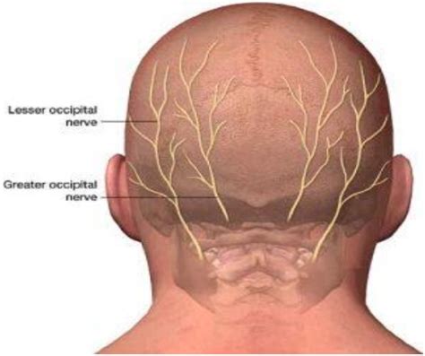 The Nerve Of Those Occipital Nerves Occipital Neuralgia Neuralgia My
