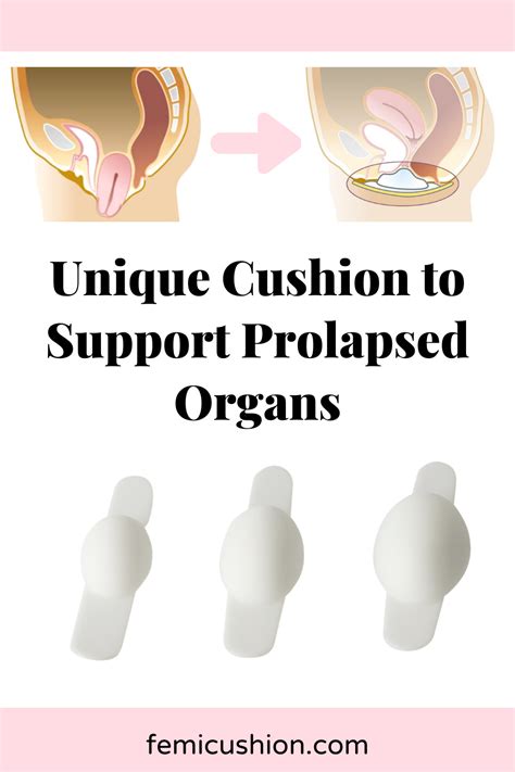 Prolapse Exercises Pelvic Organ Prolapse Pelvic Floor Exercises