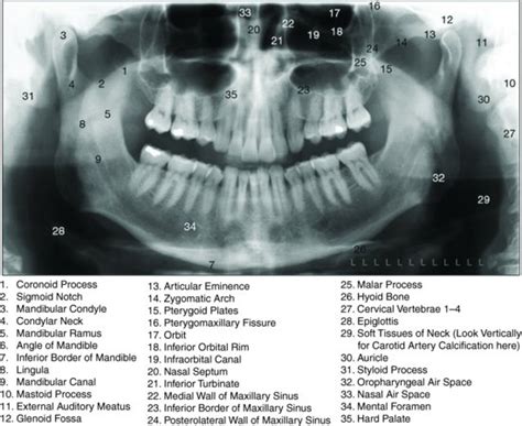 3 Radiology And The Dental Emergency Clinic Pocket Dentistry