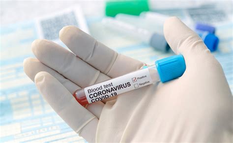 Day 2 covid pcr test for green list countries. NBA Star Donovan Mitchell Tests Positive for COVID-19