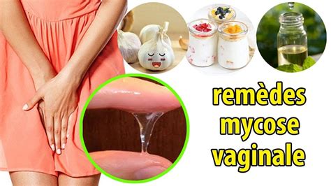 Top 5 Puissants Remèdes Maison Pour La Mycose Vaginale Conseils Youtube