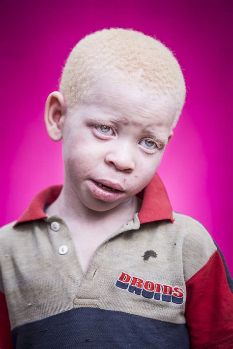 A Portrait Of A Shy Young Albino Boy Against A Pink Backdrop