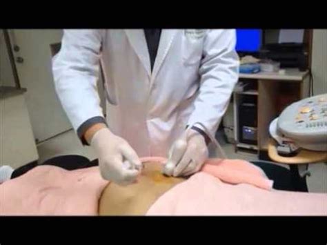 Ultrasound-Guided Sacroiliac Joint Injection Technique - YouTube