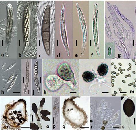 Pdf Freshwater Fungi From The River Nile Egypt Semantic Scholar